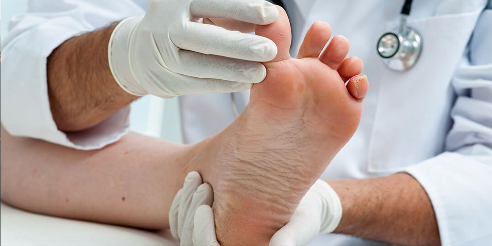 Diabetic-Foot-Care