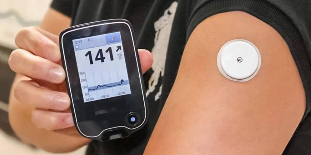 Continuous Glucose Monitoring (CGM)