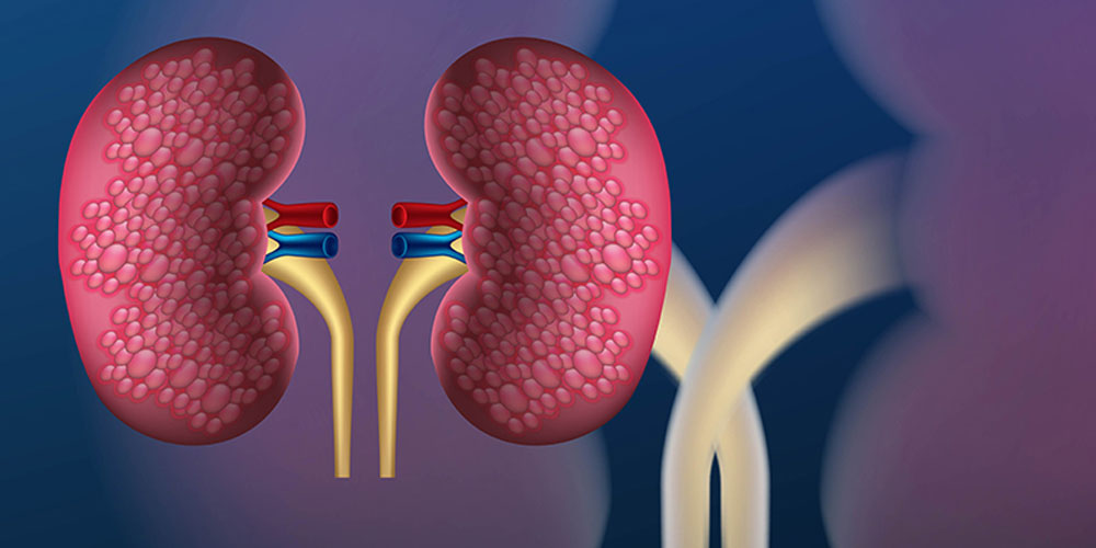 Diabetes & Kidney Disease