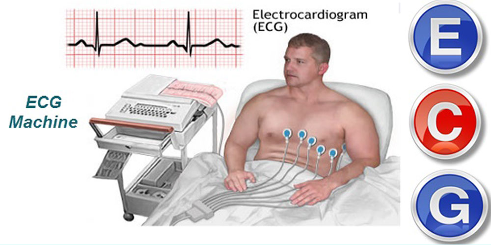 ecg-test-in-delhi